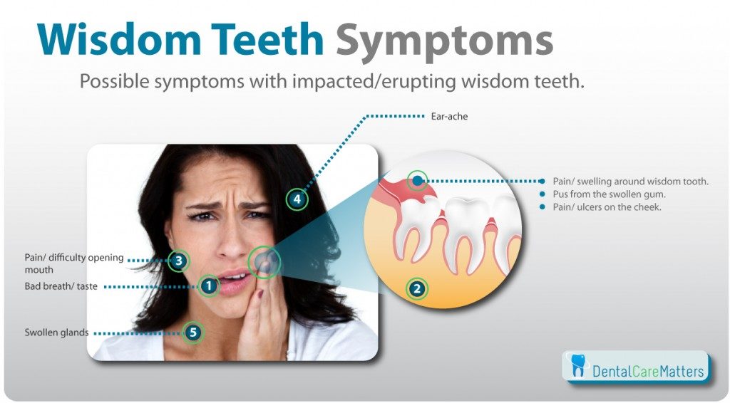 infection likely to occur in wisdom teeth