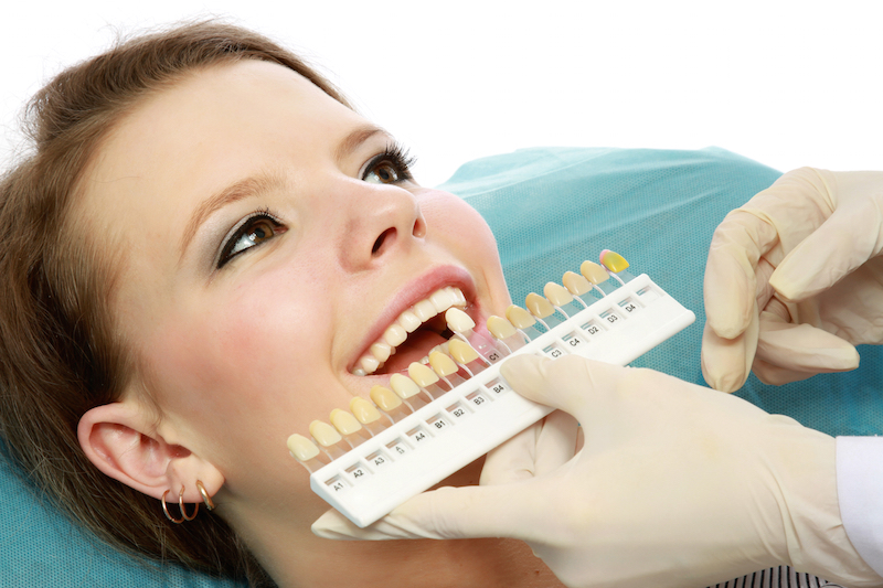 professional teeth whitening kits