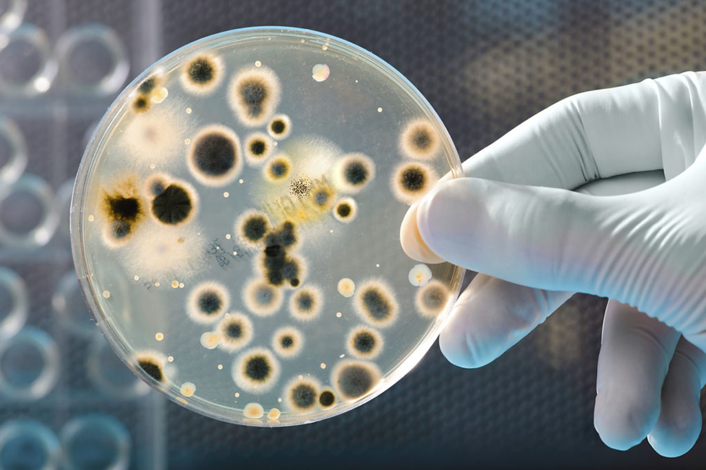 bacteria antibiotics and dental treatment 