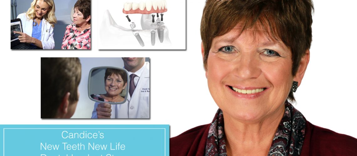 new teeth new life all-on-4 dental implant patient of dr. krakora