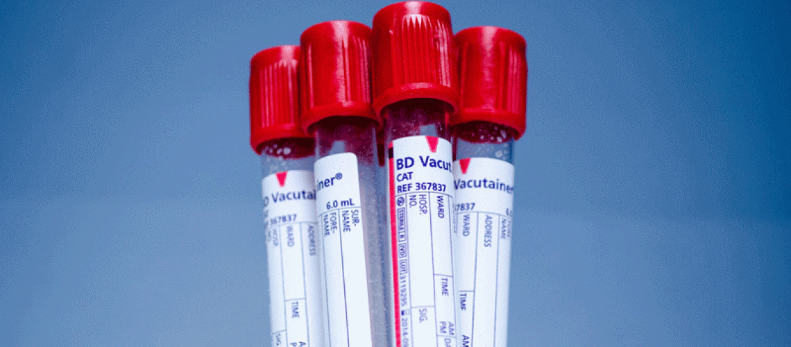 blood samples-blood platelets