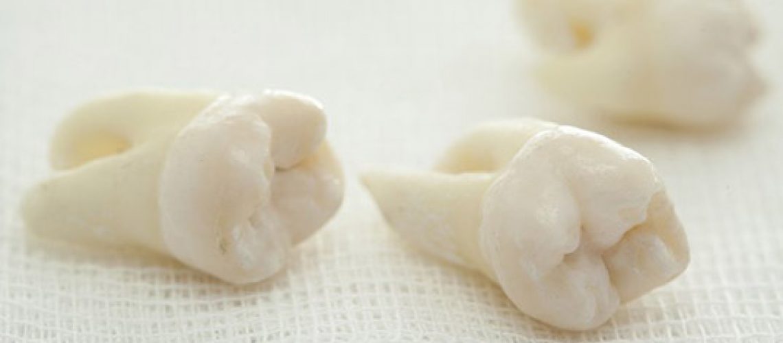 wisdom teeth removal in pittsburgh